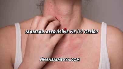Mantar Alerjisine Ne İyi Gelir?