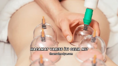 Hacamat Varise İyi Gelir mi?