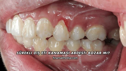 Sürekli Diş Eti Kanaması Abdesti Bozar mı?