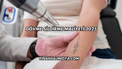 Dövme Sildirme Maliyeti 2025