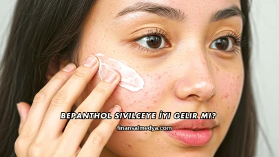 Bepanthol Sivilceye İyi Gelir mi?