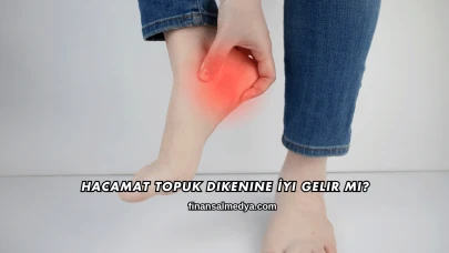 Hacamat Topuk Dikenine İyi Gelir mi?