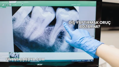 Diş Yaptırmak Oruç Bozar mı?