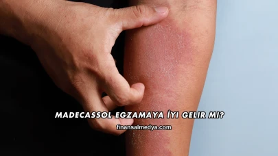 Madecassol Egzamaya İyi Gelir mi?