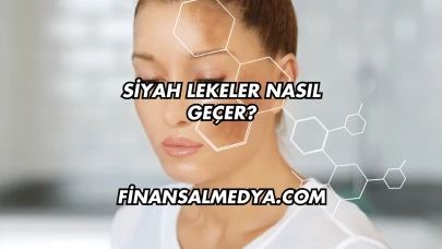 Siyah Lekeler Nasıl Geçer?