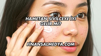 Hametan Sivilceye İyi Gelir mi?