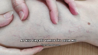 At Kılı Fırçası Varise İyi Gelir mi?