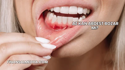 Az Kan Abdest Bozar mı?