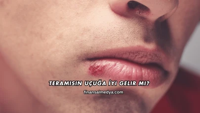 Teramisin Uçuğa İyi Gelir mi?