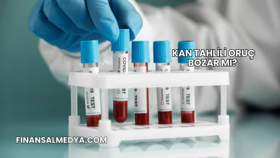 Kan Tahlili Oruç Bozar mı?