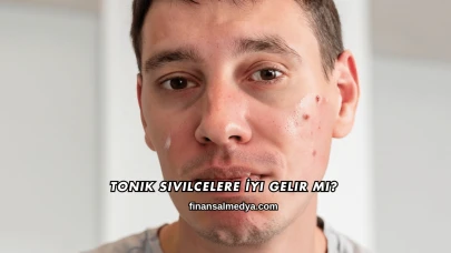 Tonik Sivilcelere İyi Gelir mi?