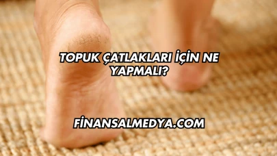 Topuk Çatlakları İçin Ne Yapmalı?