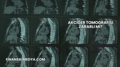 Akciğer Tomografisi Zararlı mı?