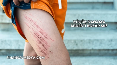 Küçük Kanama Abdesti Bozar mı?