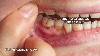 Diş Plağı Orucu Bozar mı?