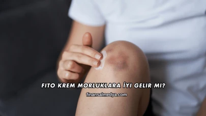 Fito Krem Morluklara İyi Gelir mi?