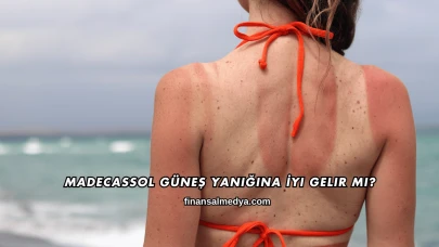 Madecassol Güneş Yanığına İyi Gelir mi?