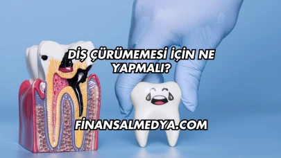 Diş Çürümemesi İçin Ne Yapmalı?