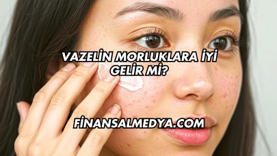 Vazelin Morluklara İyi Gelir mi?