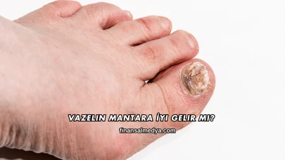 Vazelin Mantara İyi Gelir mi?