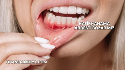 Hafif Kanama Abdesti Bozar mı?