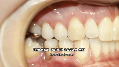 Isırmak Orucu Bozar mı?