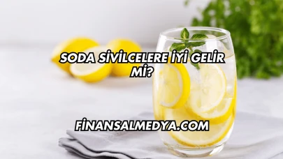 Soda Sivilcelere İyi Gelir mi?