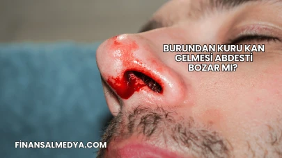 Burundan Kuru Kan Gelmesi Abdesti Bozar mı?