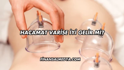 Hacamat Varise İyi Gelir mi?