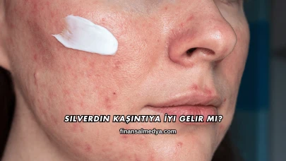 Silverdin Kaşıntıya İyi Gelir mi?