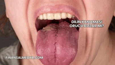 Dilin Kanaması Orucu Bozar mı?