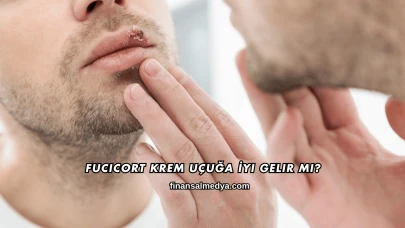 Fucicort Krem Uçuğa İyi Gelir mi?