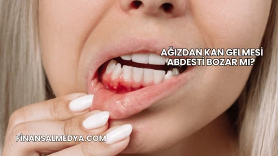 Ağızdan Kan Gelmesi Abdesti Bozar mı?