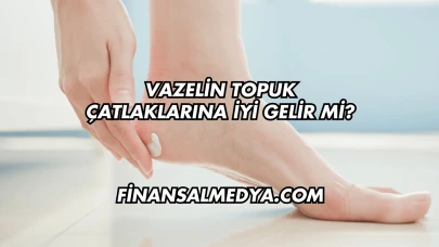 Vazelin Topuk Çatlaklarına İyi Gelir mi?