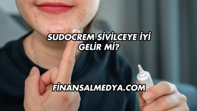 Sudocrem Sivilceye İyi Gelir mi?