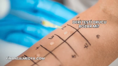 Deri Testi Orucu Bozar mı?