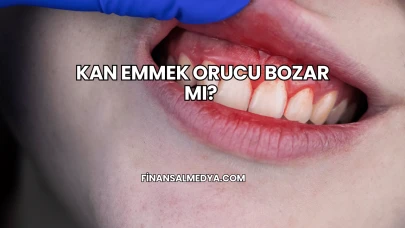 Kan Emmek Orucu Bozar mı?