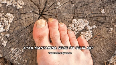 Ayak Mantarına Sirke İyi Gelir mi?