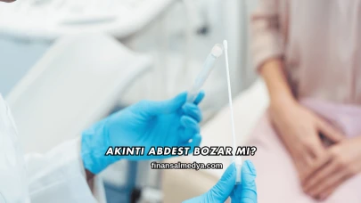 Akıntı Abdesti Bozar mı?