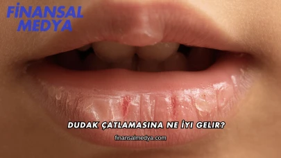 Dudak Çatlamasına Ne İyi Gelir?