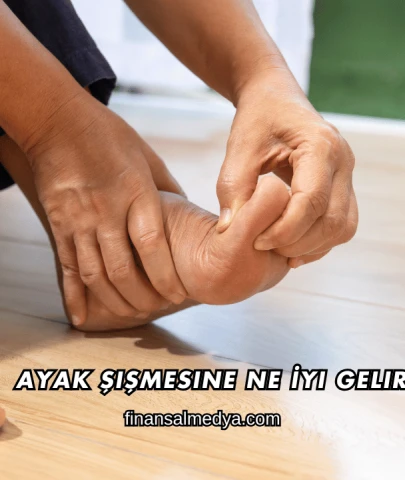 Ayak Şişmesine Ne İyi Gelir?
