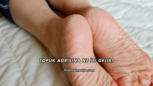 Topuk Ağrısına Ne İyi Gelir?