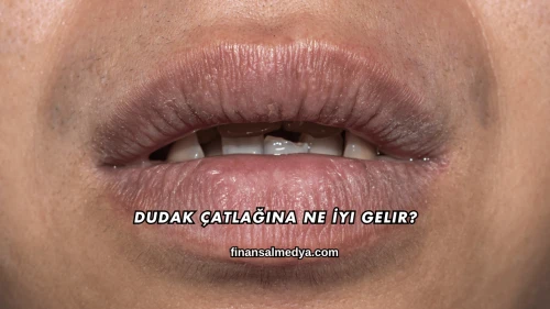 Dudak Çatlağına Ne İyi Gelir?
