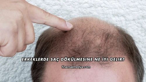 Erkeklerde Saç Dökülmesine Ne İyi Gelir?