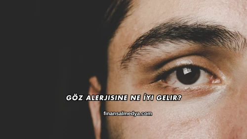 Göz Alerjisine Ne İyi Gelir?