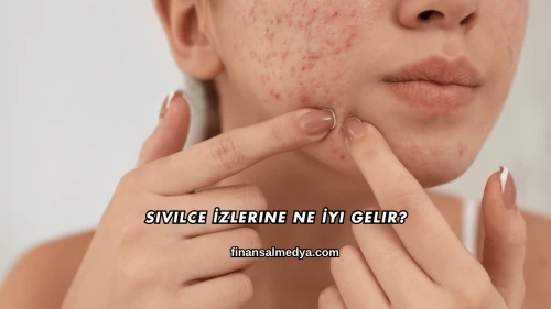 Sivilce İzlerine Ne İyi Gelir?