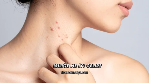 Isiliğe Ne İyi Gelir?