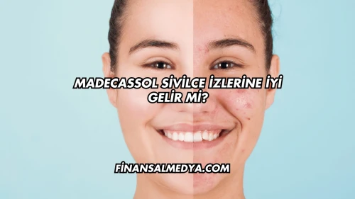 Madecassol Sivilce İzlerine İyi Gelir mi?