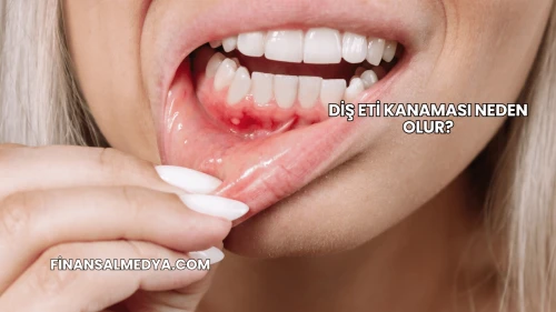 Diş Eti Kanaması Neden Olur?