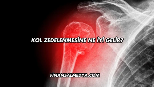 Kol Zedelenmesine Ne İyi Gelir?